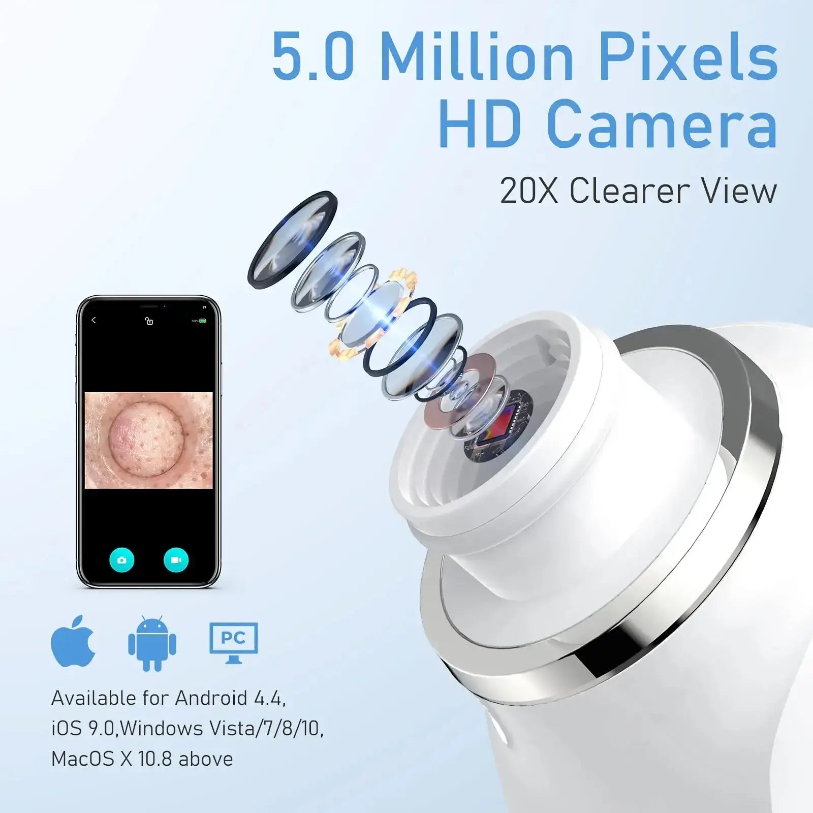 Visual Blackhead Remover