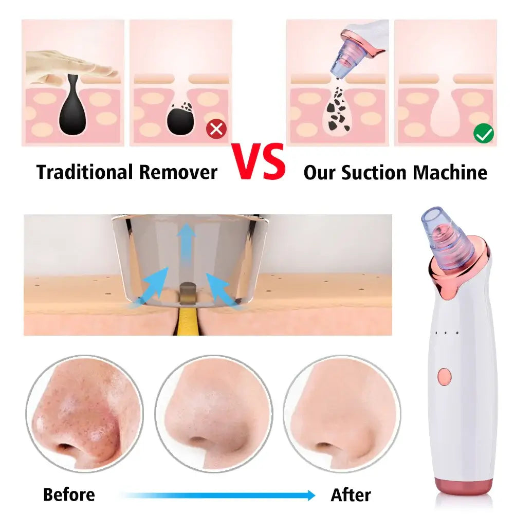 Pore Vacuum