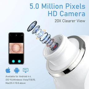 Visual Blackhead Remover