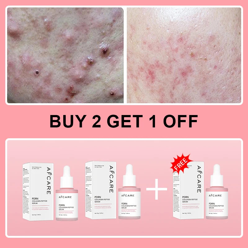 Collagen Peptide Serum for Skin Renewal